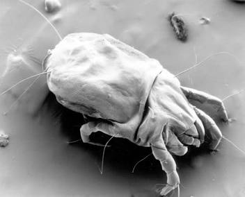 House Dust Mites (Dermatophagoides) Microscopic View